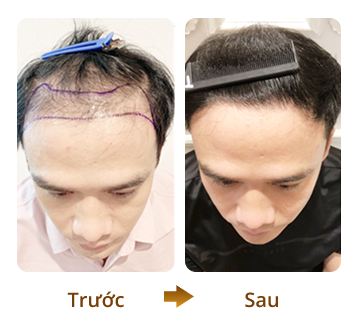 Khách hàng 3